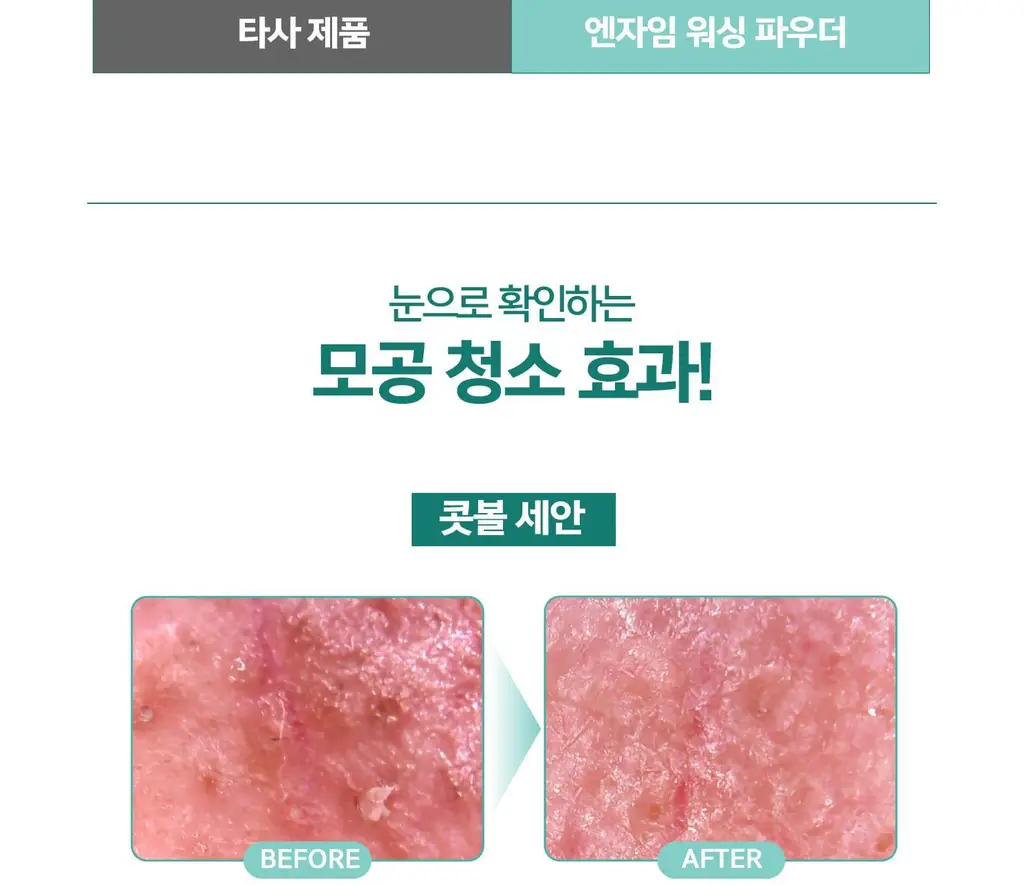 [민감성/여드름성피부적합] 테라비코스 엔자임 워싱 파우더 40g 상세페이지 27